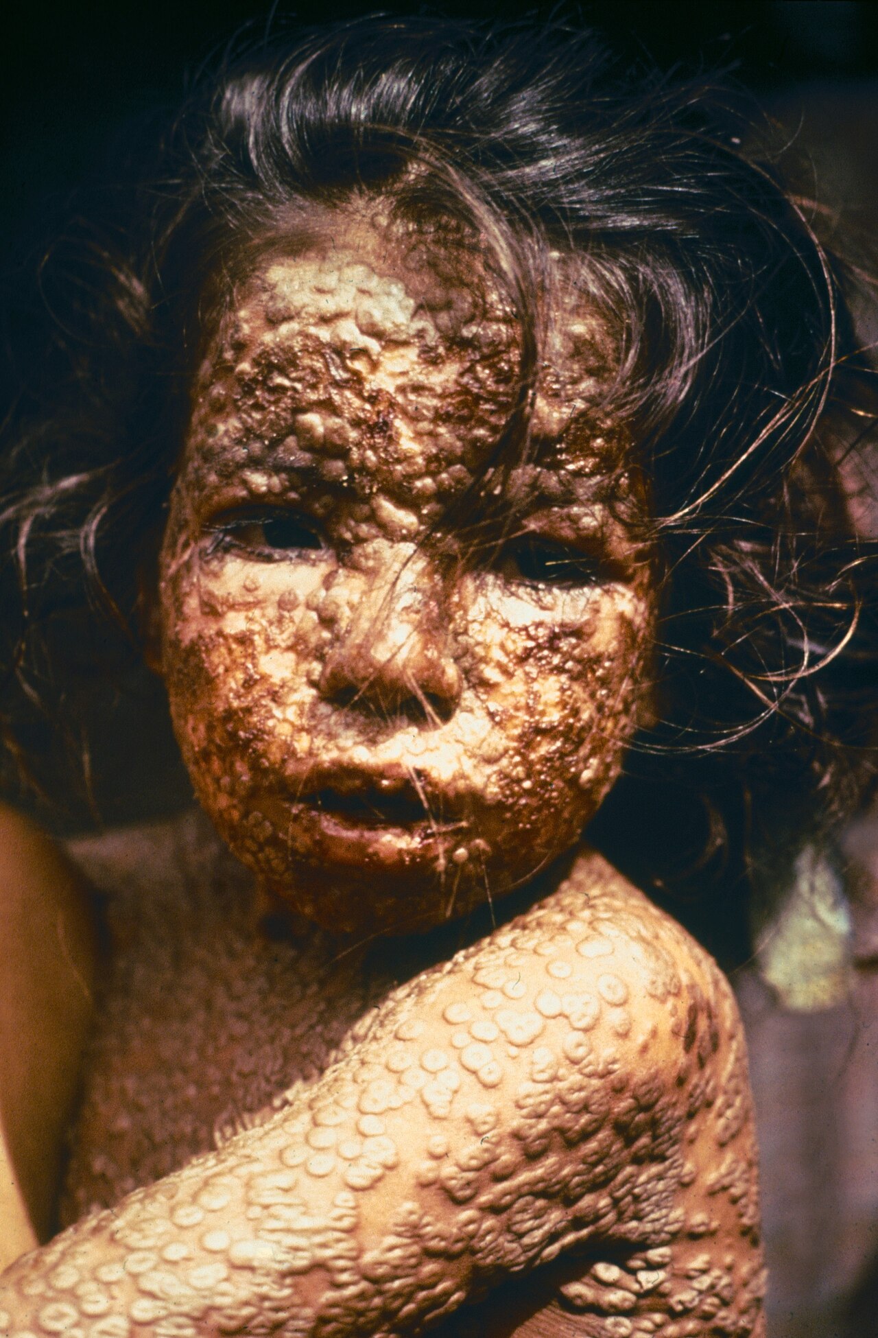 Child